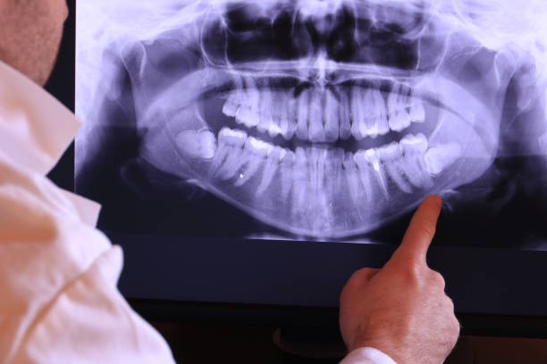 Best Broken or Cracked Tooth Emergency Dentist in Winchester, OH
