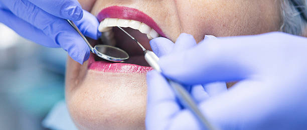 Best Emergency Dental Extractions in Winchester, OH